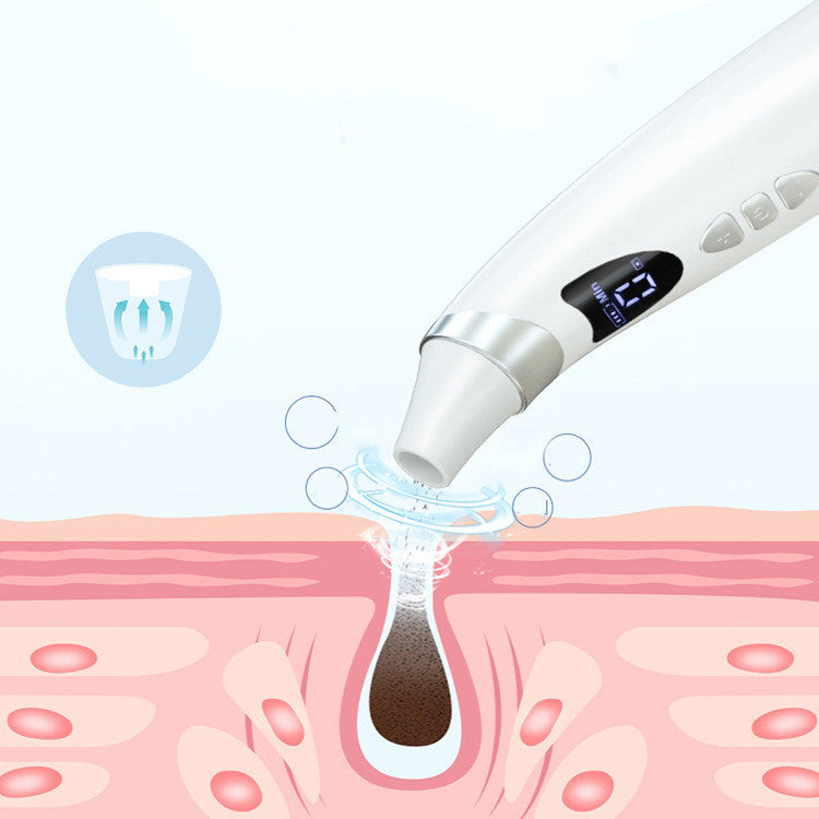 Aurelian & Co. Visual Blackhead Suction Pore Cleaner with HD Display